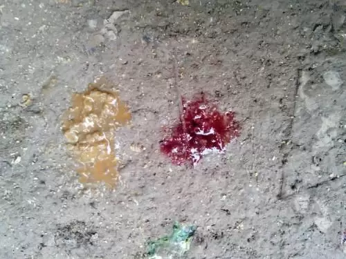 天气原因鸡子球虫肠炎的症多发,如何防控,小妙招轻松搞定插图 天气原因鸡子球虫肠炎的症多发,如何防控,小妙招轻松搞定插图