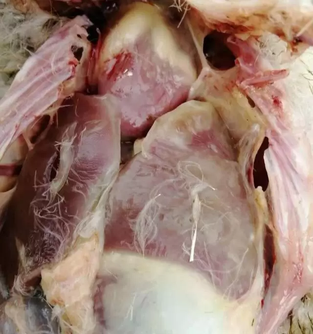 浆膜炎的症状与治疗插图2