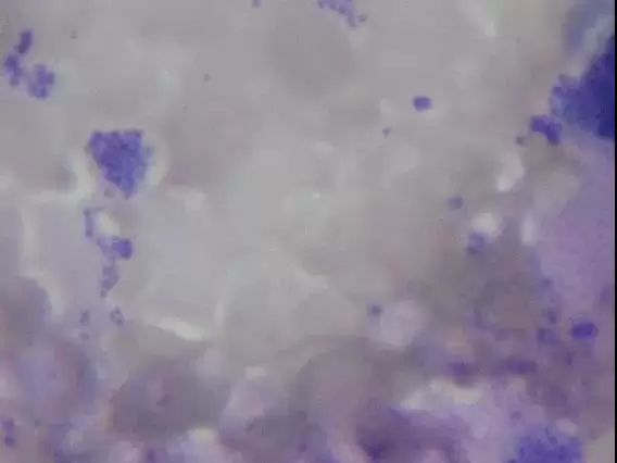 伊拉肉兔球虫继发葡萄球菌感染的诊治插图1