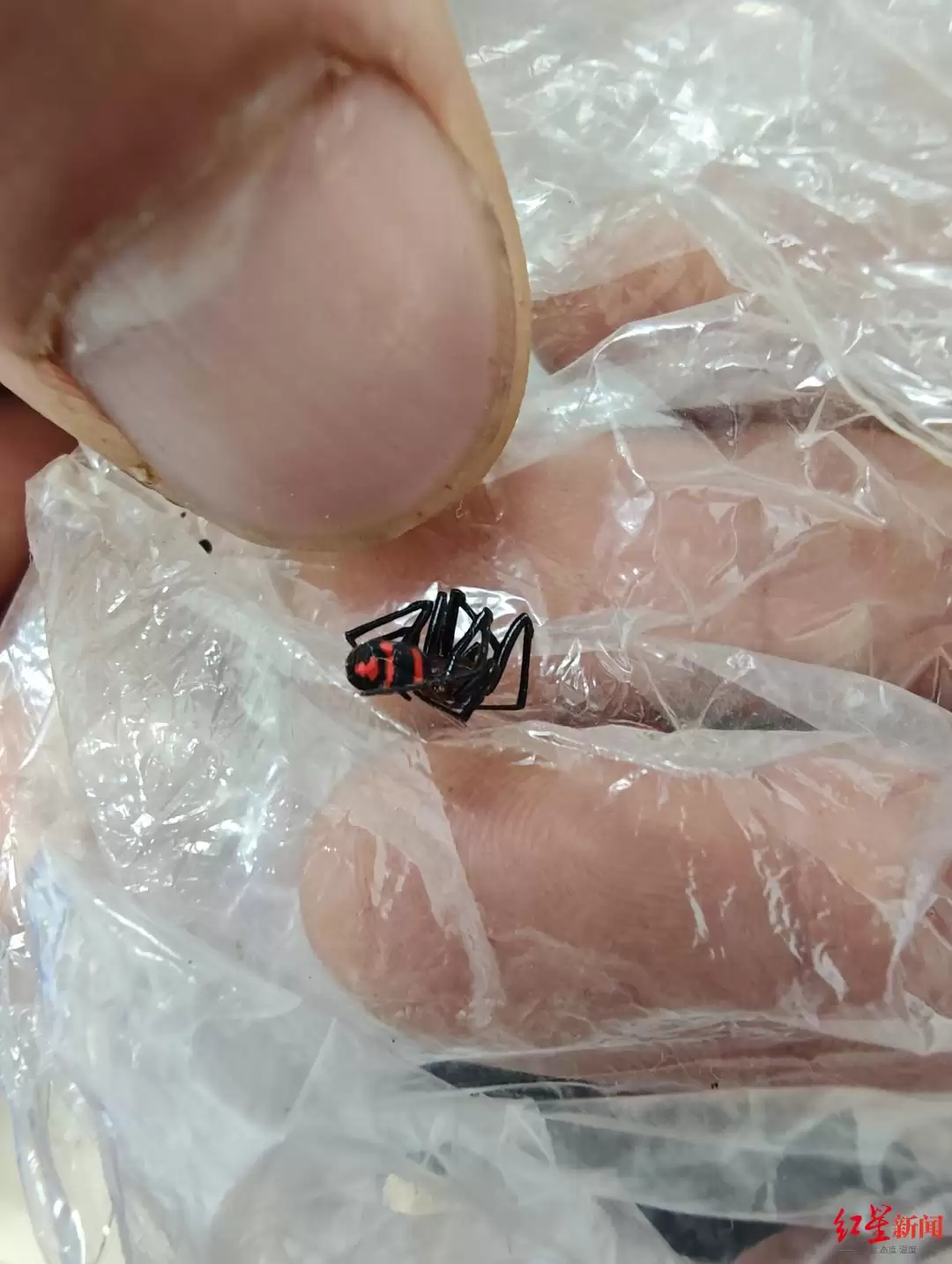 四川凉山青年被罕见 “怪肥腹蛛” 咬伤，专家详解毒性及被咬 “救命四步”插图1